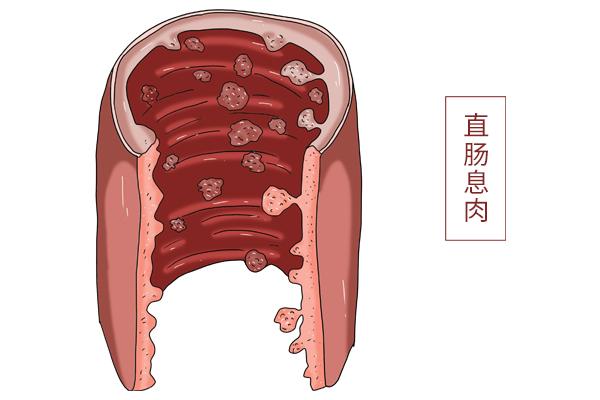 做一次肠镜能管多长时间