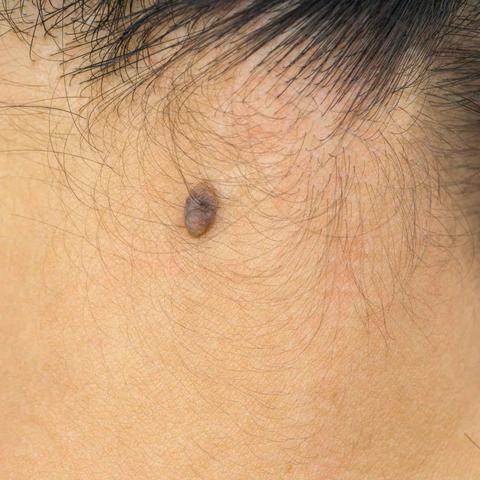 福州哪里有比较好的皮肤科小诊所？