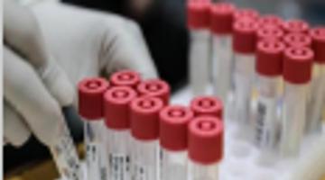 四川新增本土确诊病例4例
 /四川新增本土确诊病例4例是哪里的