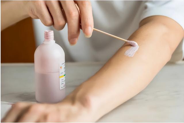 宝宝和孕妇得了荨麻疹能用炉甘石洗剂吗
