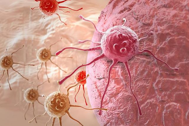 我国常见的几种癌症是什么 我国常见的几种癌症是什么