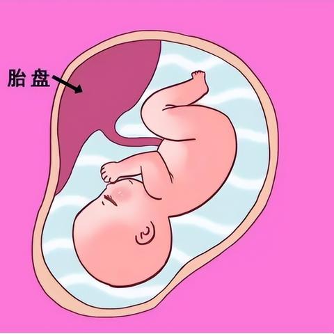 膀胱膨出苏州市中医院怎么样