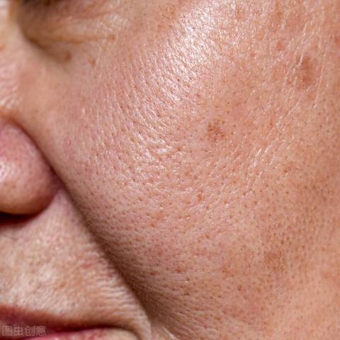 苏州常熟市索尔祛痘的长尾关键词有哪些