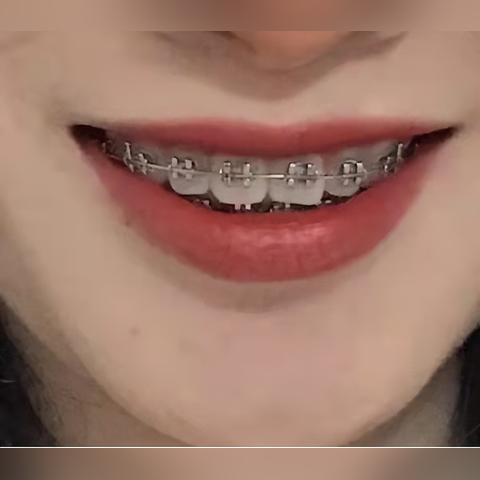 南宁同步口腔避雷的相关长尾关键词有哪些