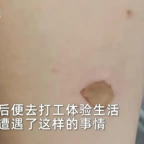 西安市初中休学怎么办