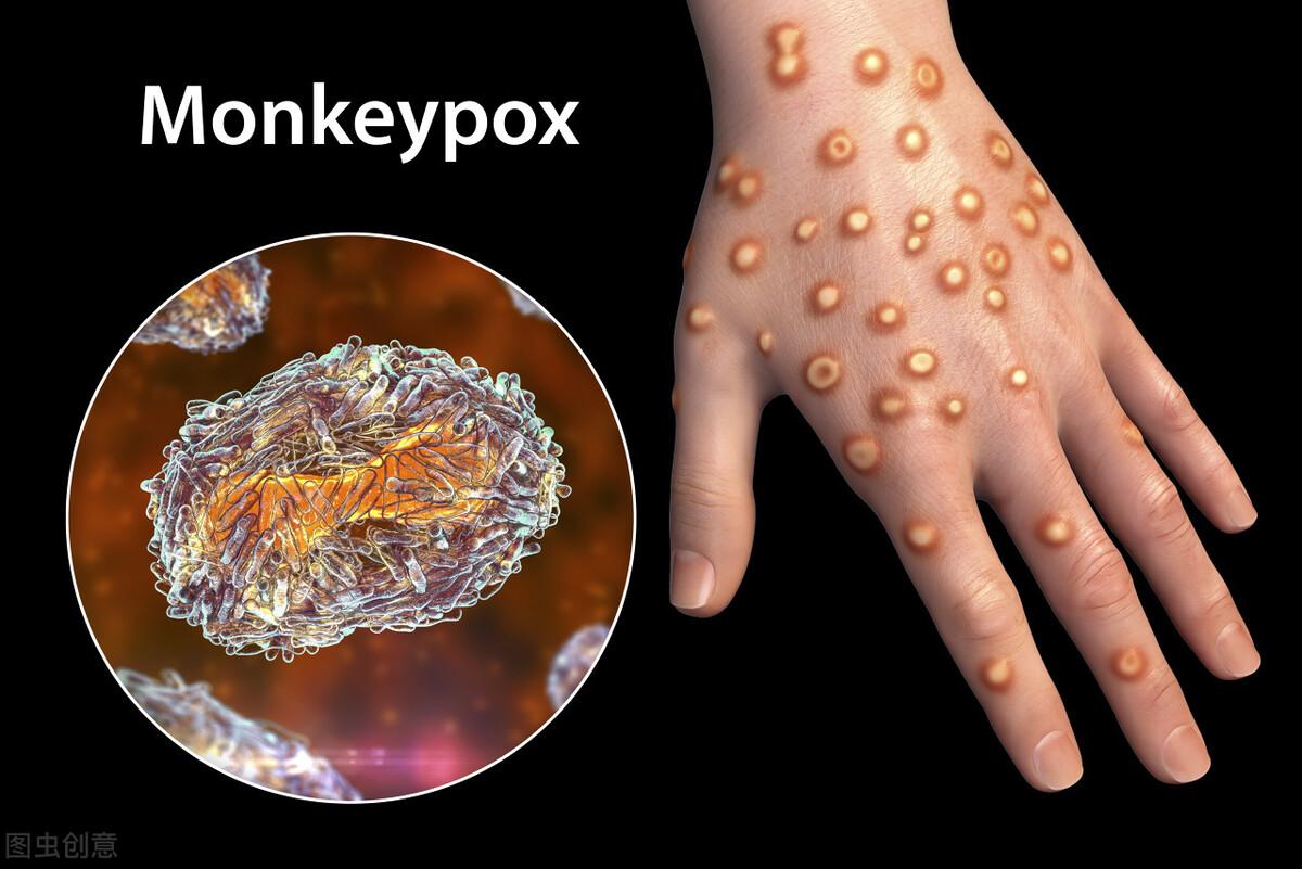 北京禽流感最新消息
 ,北京禽流感最新消息新闻