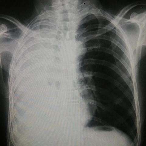 河南平顶山市郏县的新冠肺炎为什么不报？