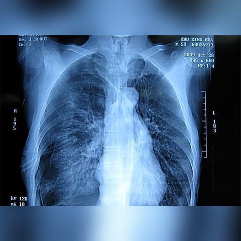 武汉市社保转移需要什么