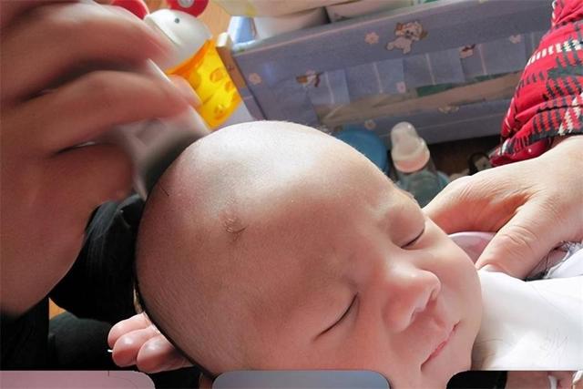 经常剃头头发可以变粗吗