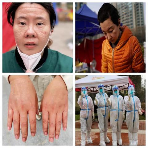 西安市红码怎么做核酸