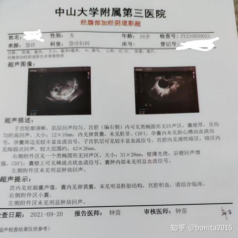 广州市和深圳市哪个美
