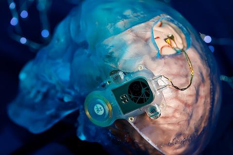 脑机接口临床应用