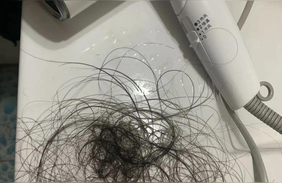 女人梦见自己掉头发