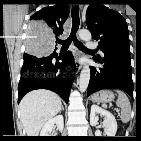 河南旅游景点图片治愈的相关长尾关键词有哪些