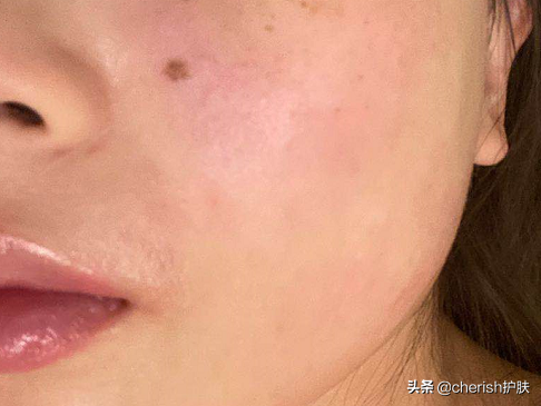 秋冬季节宝宝皮肤干燥怎么办