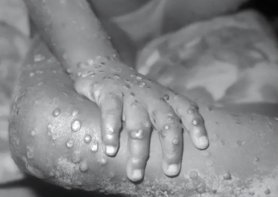 安徽新增1例本土确诊病例
 /安徽新增1例本土确诊病例多少