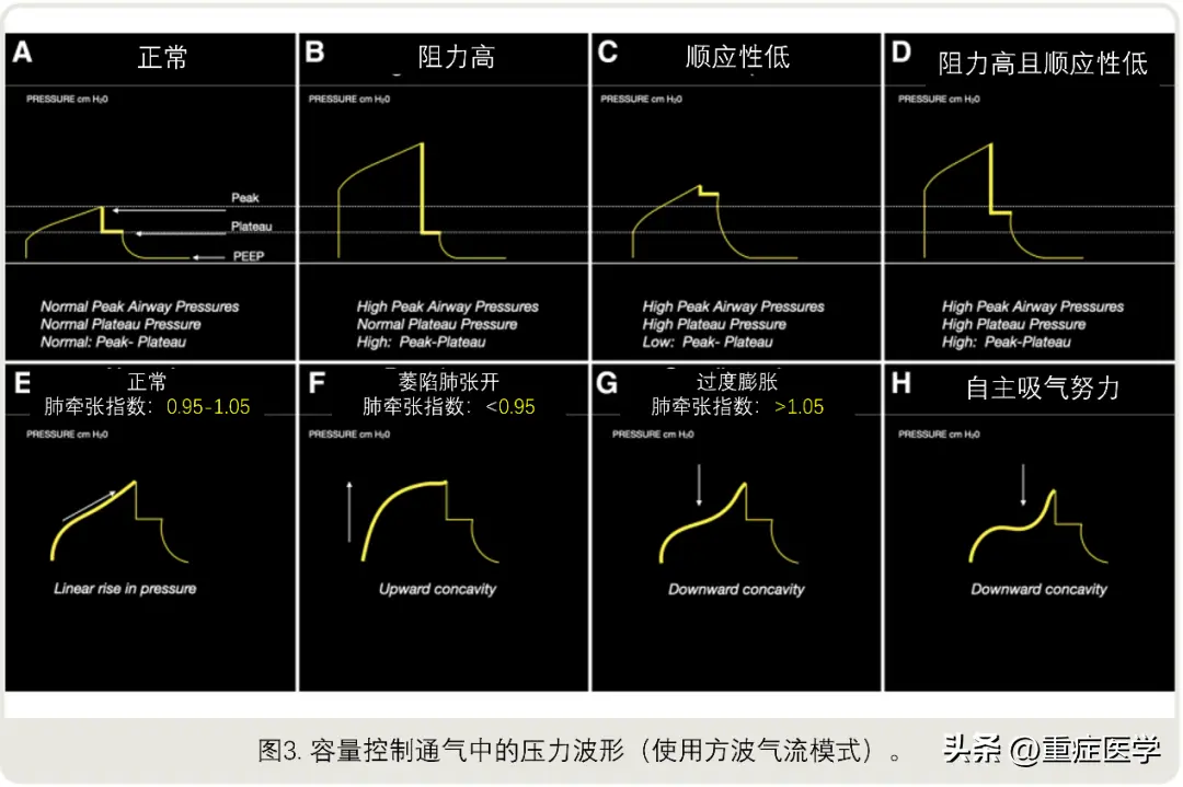 付费网站英语表达技巧 跨境电商英语怎么表达
