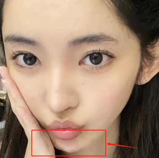 男网红变性后又整容，内眼角直接变菱形，网红圈整容成风影响太坏
