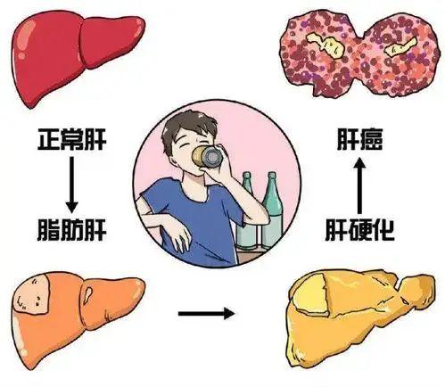 儿童营养过剩会引起糖尿病吗