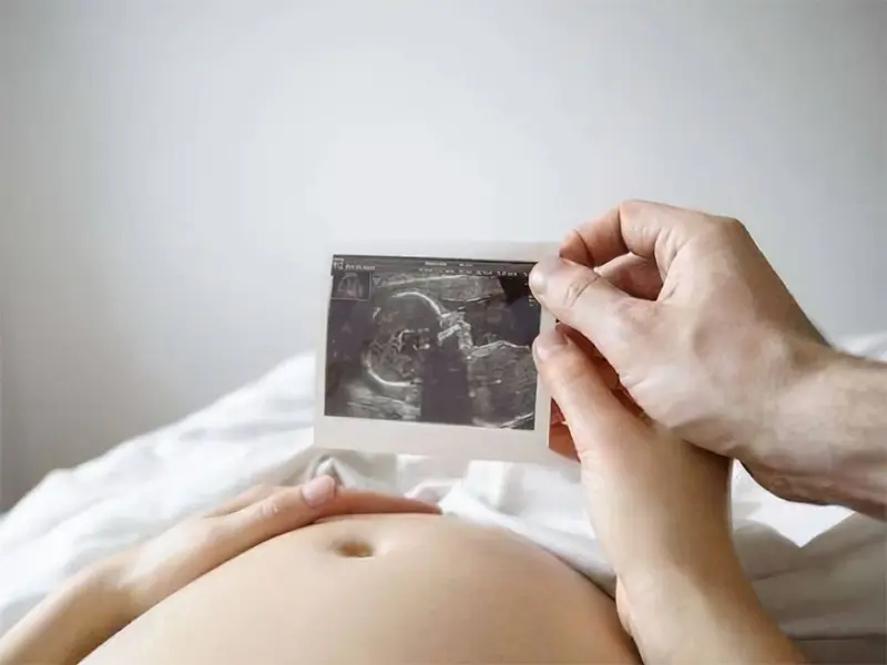 侧脸这首歌的外链是什么 cps侧脸怎么p