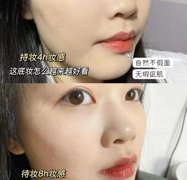 长期戴口罩脸上反复长痘怎么办
