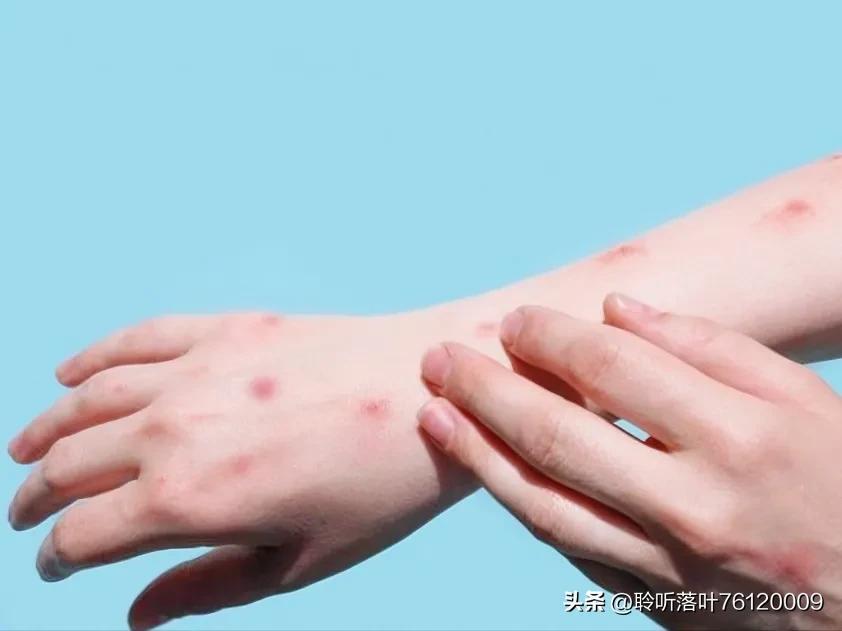 【北京新增本土确诊7例 无症状2例
 ,北京新增本土确诊7例 无症状2例病例】