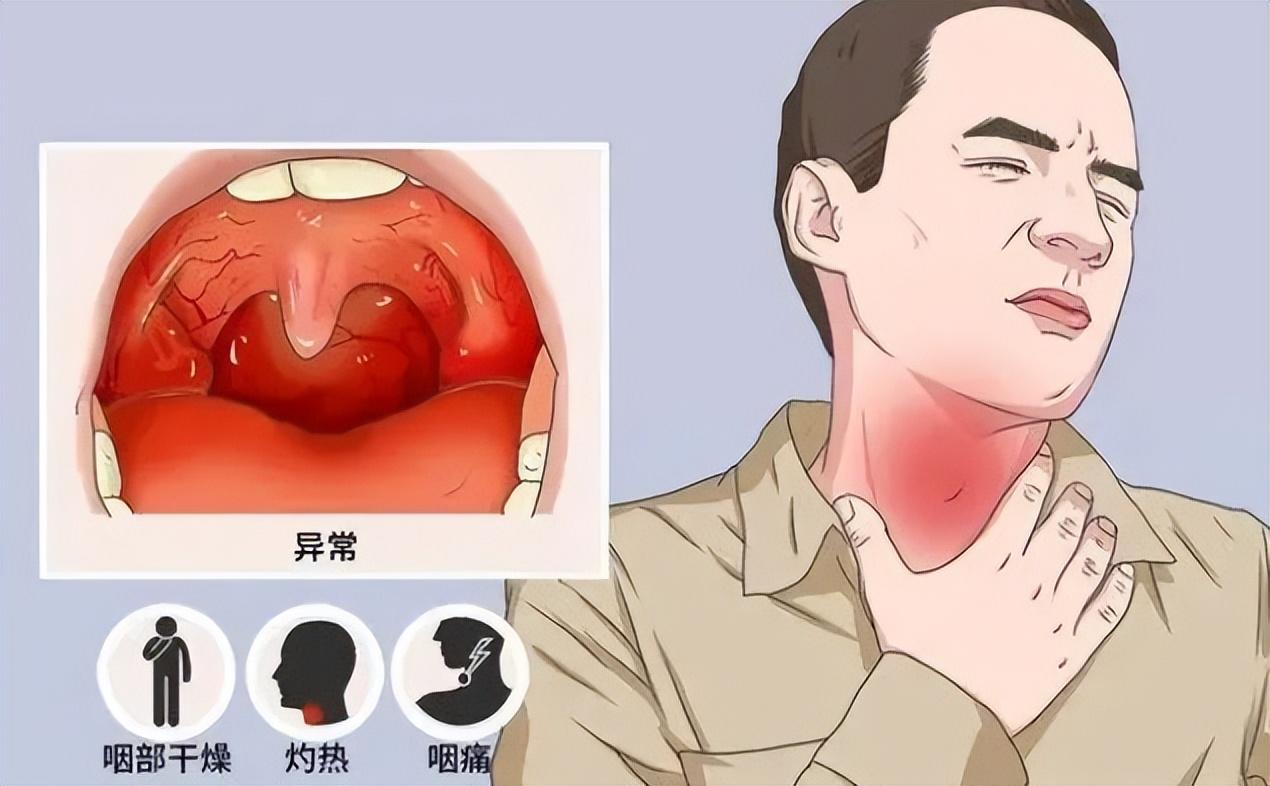 【嗓子疼是新冠二阳吗
 ,嗓子疼是新冠二阳吗吃什么药】