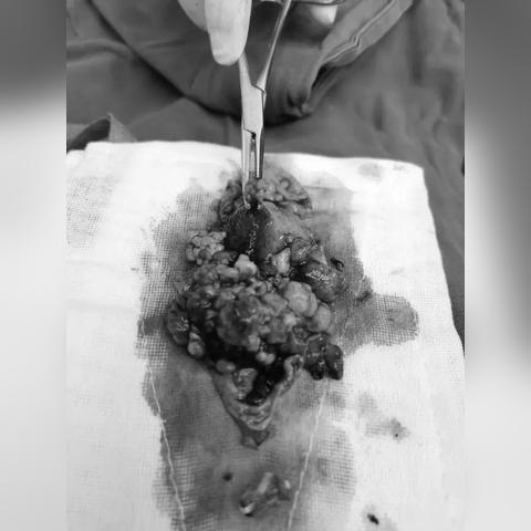 深圳市胃息肉哪个医院好