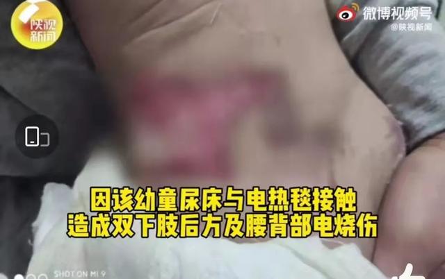 用尿不湿要注意哪些问题