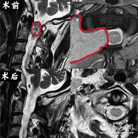 西安中考复查分数的流程？