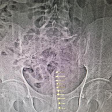 西安市泌尿外科怎么样