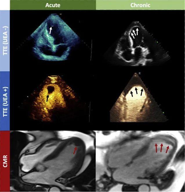 医学影像学杂志文献综述咒怨讲的什么