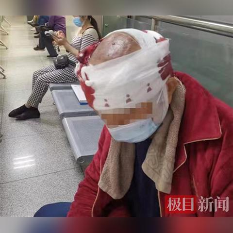 武汉新生植发怎样？