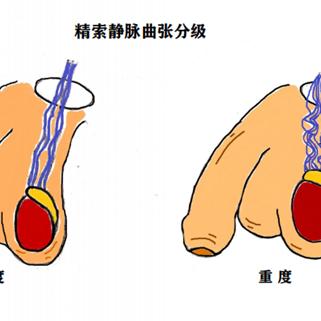 前列腺炎自愈需要做什么的长尾关键词有哪些