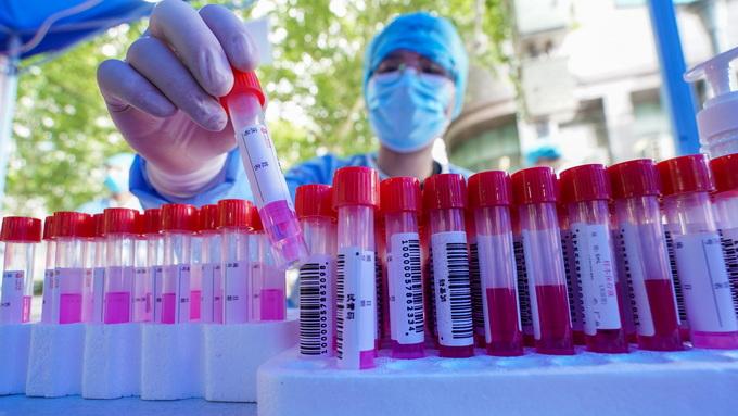 【河南新增3例本土感染者 在3地
,河南新增3例本土确诊】 【河南新增3例本土感染者 在3地
,河南新增3例本土确诊】