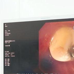 石家庄市四院全麻的长尾关键词有什么