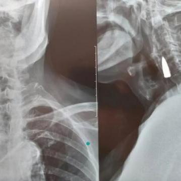 临沂市全身查体中心的长尾关键词有哪些