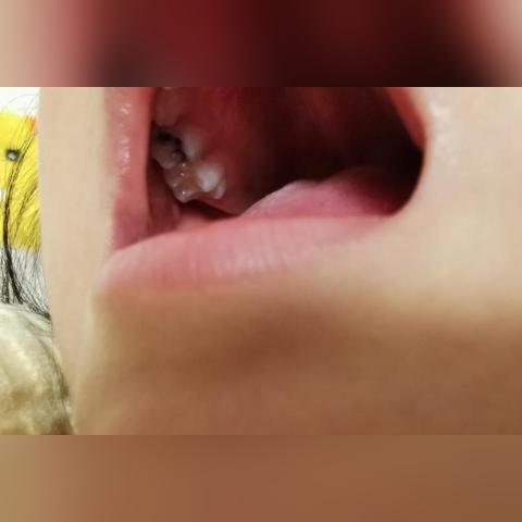 杭州市第一人民医院补牙哪个科室