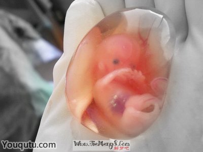 梦醒时分，解析梦见与男友分手后选择吃药打胎的深层含义