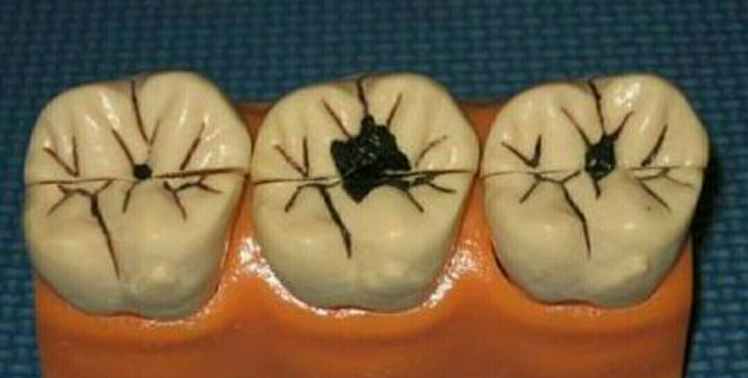 梦境迷离，解读做梦梦到自己掉牙齿的深层含义