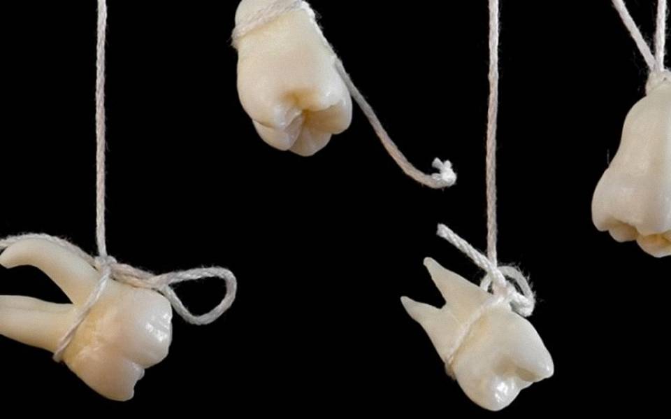 梦到自己牙齿掉了4颗，解析梦境背后的深层含义与心理暗示