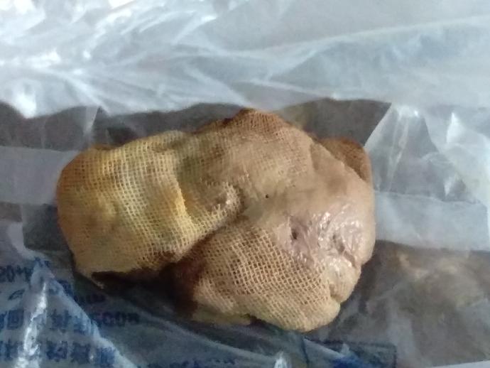梦境奇景，解析梦见男人怀孕并摔下楼梯流产的深层含义