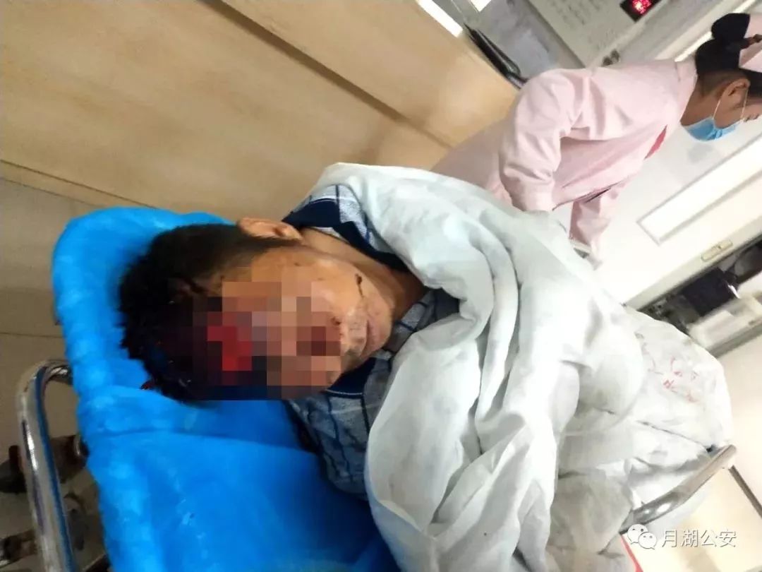 解析梦境，昨天晚上梦见额头出血的象征意义与深层含义