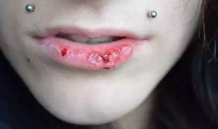 梦境解析，为何晚上经常梦到牙齿被咬掉？