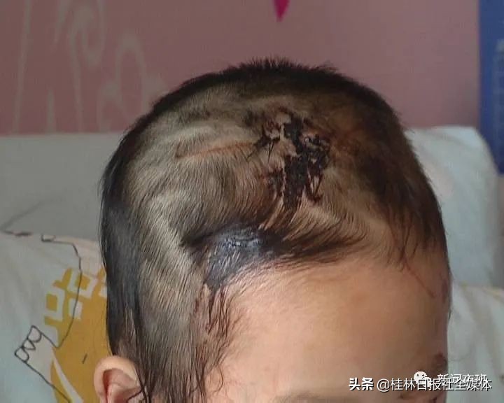 昨晚上做梦梦见被两只大黄狗咬，梦境背后的深层含义与预示