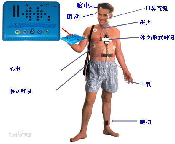 健康监测十大品牌排行榜