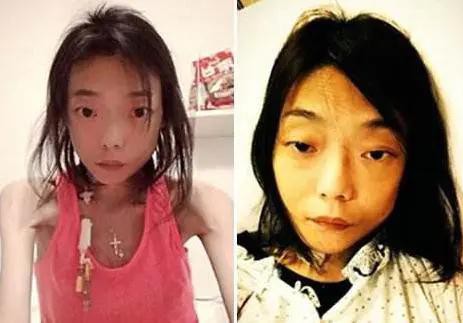 梦见自己的牙齿掉光，探索梦境背后的深层含义与心理解析