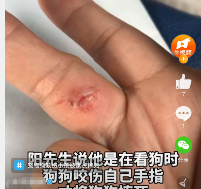 请高手解梦，连续三次梦见狗，特别是两次梦见被狗咬屁股——解密梦境中的隐秘信号