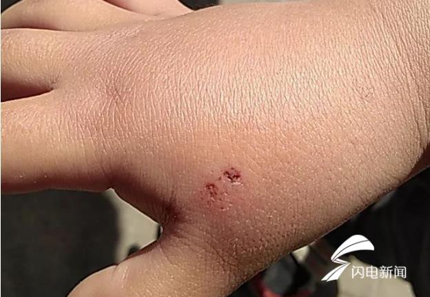 梦到被老鼠咬手，深层次的心理解析与寓意