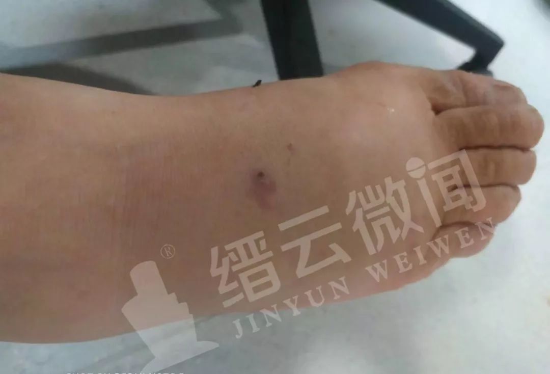 女生梦中蛇影，解析未被咬伤的梦境寓意